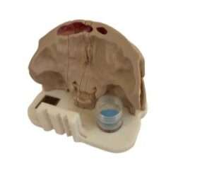 Bookface Sinus Model showing the tumour box positioned within the anatomical model