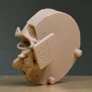 Temporal Bone MAX bottom