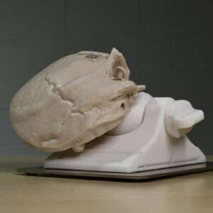 Temporal Bone MAX with mount