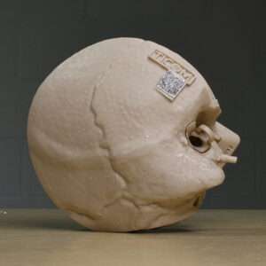 Temporal Bone MAX top
