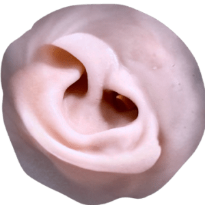 Exostosis Model ear only