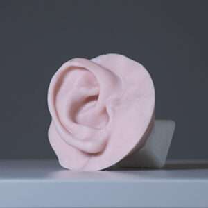 Exostosis Model full ear