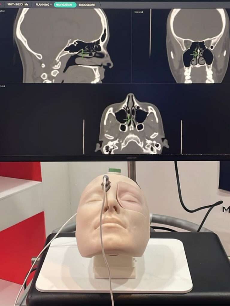 Industry partners Lanoy Medical showcasing their navigation equipment using the Transorbital Surgical Simulation Model