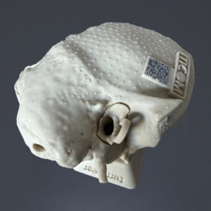 Temporal Bone REG